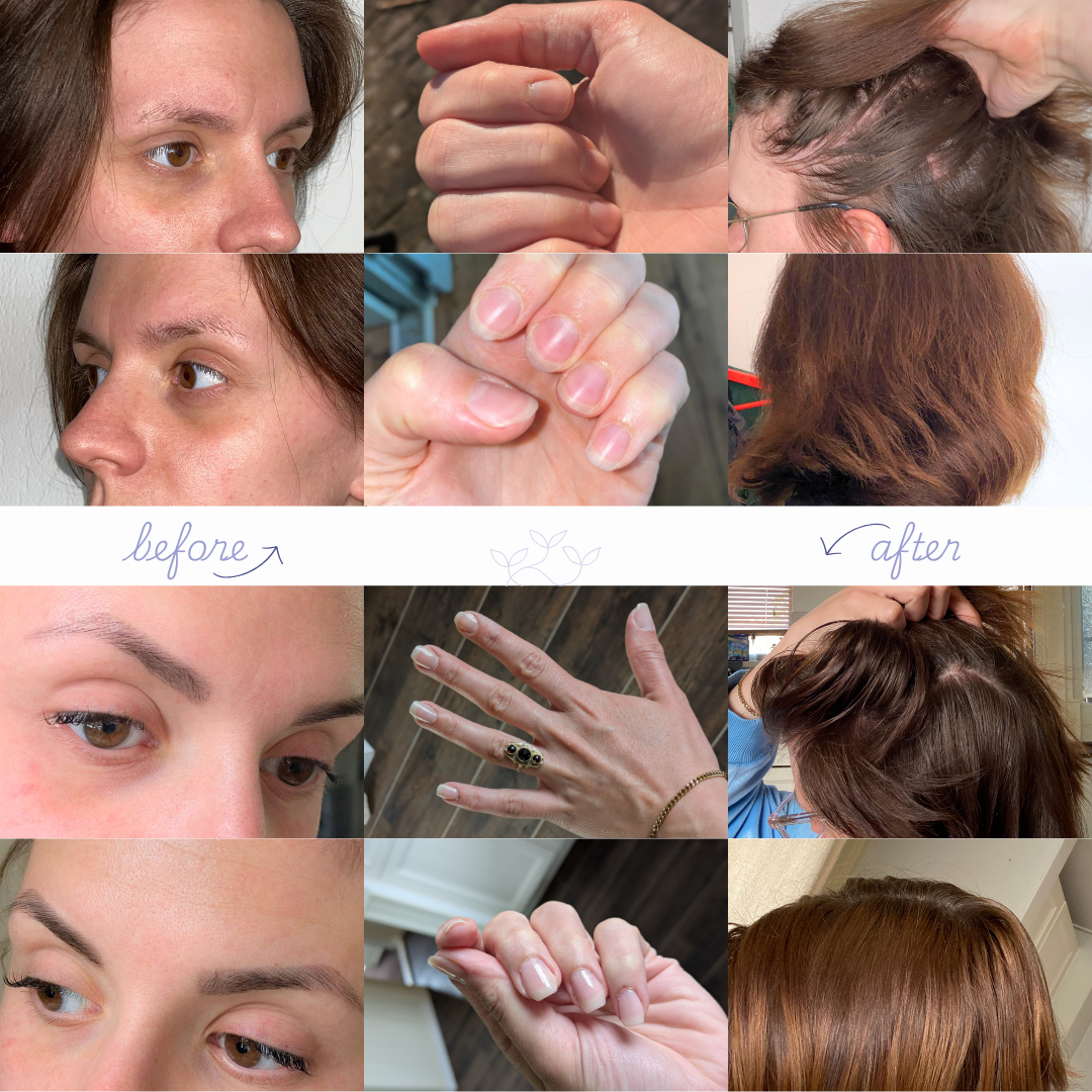 Before & after foto's van een gebruikster van dit product. After foto's zijn zo'n 8 maanden na start gebruik genomen.